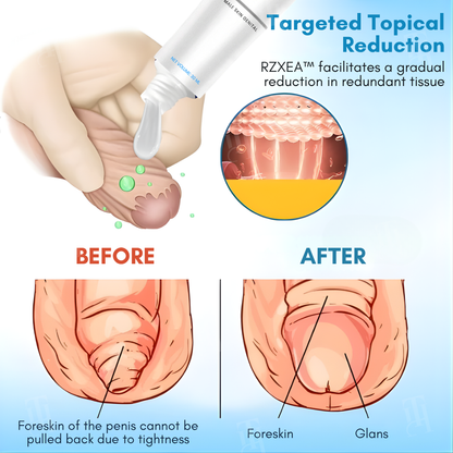 ⚡RZXEA™ Foreskin Elasticity Gel: Restore Your Edge, Restart Your Vitality.