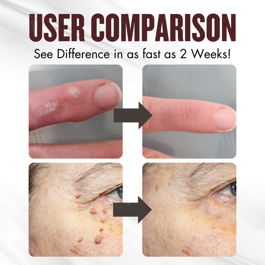🛡️Repairs While Removing + 100% Acid-Free🌿Cvreoz® All-in-1 Ceramide Skin Cream