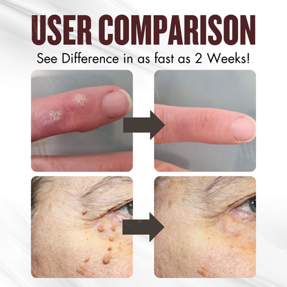 🛡️Repairs While Removing + 100% Acid-Free🌿Cvreoz® All-in-1 Ceramide Skin Cream