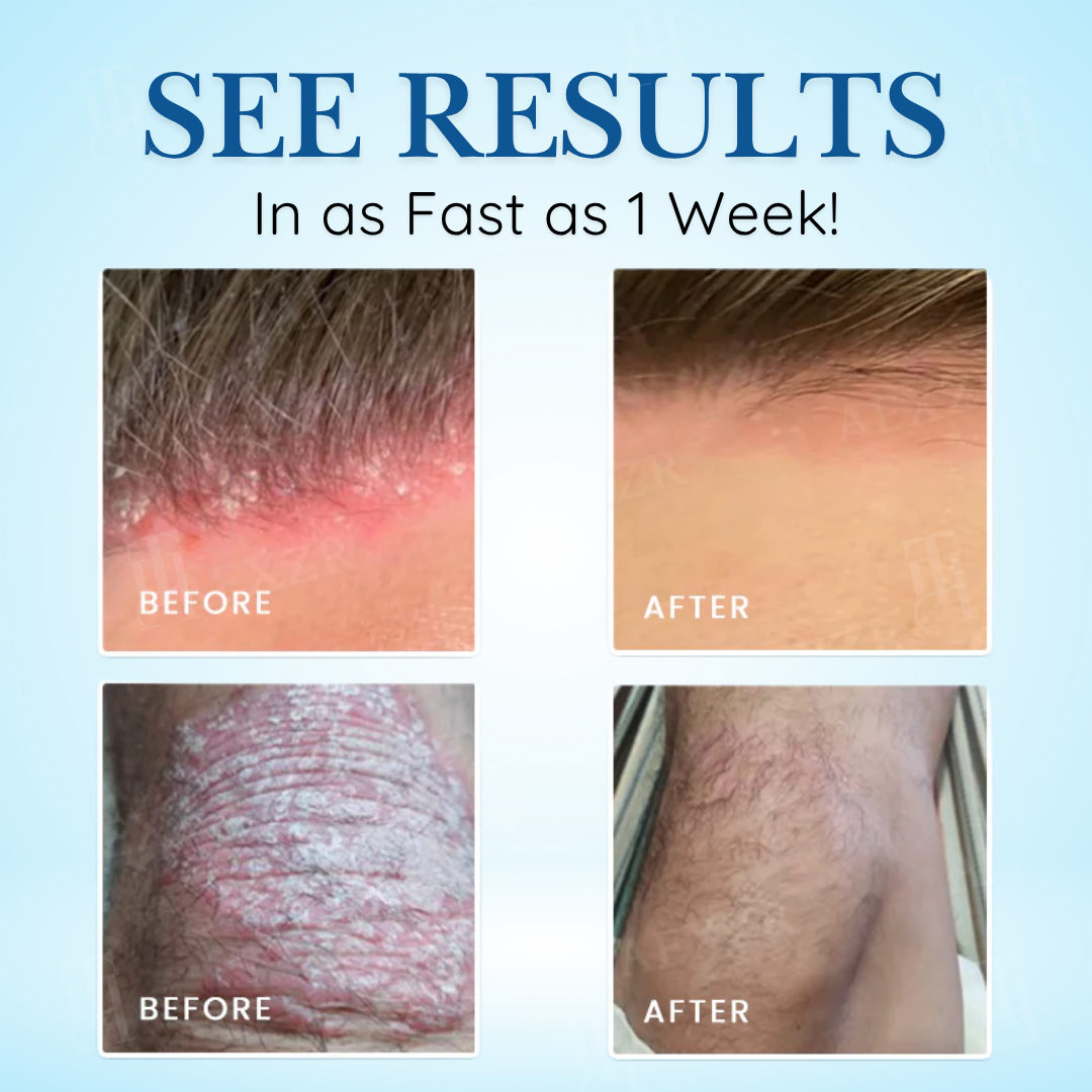 ✅DOCTOR RECOMMENDED + 20,000+ SUCCESS STORIES🎯Cvreoz® Source-Relief Magnesium Spray