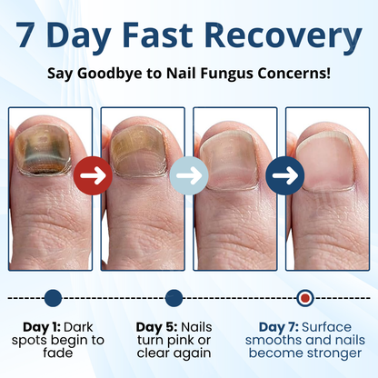 ⚡Visible Results In 2 Days + Professional Grade Repair🏥AEXZR® MycoShield Pro Fungal Nail Patches