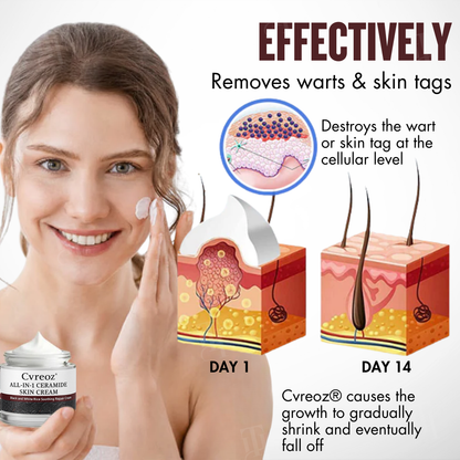 🛡️Repairs While Removing + 100% Acid-Free🌿Cvreoz® All-in-1 Ceramide Skin Cream