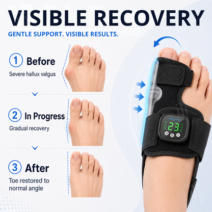 AEXZR® Nexalign Pro — EMS Bunion Corrector