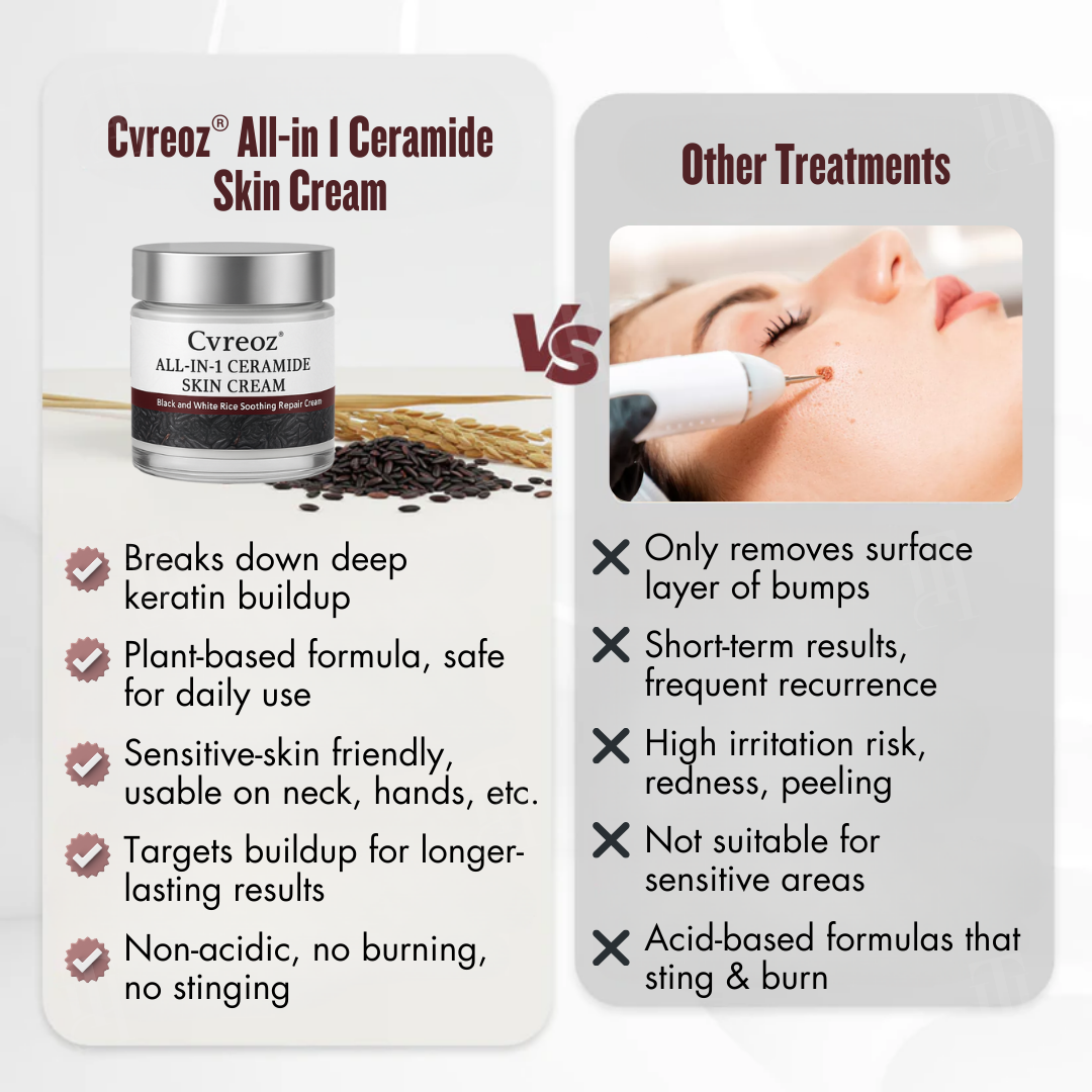 🛡️Repairs While Removing + 100% Acid-Free🌿Cvreoz® All-in-1 Ceramide Skin Cream