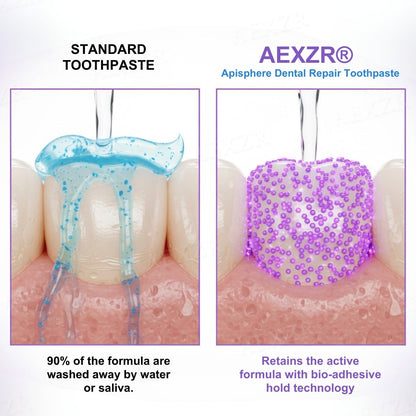 🔥 BLACK FRIDAY: 34% OFF | AEXZR® Apisphere Dental Repair Toothpaste