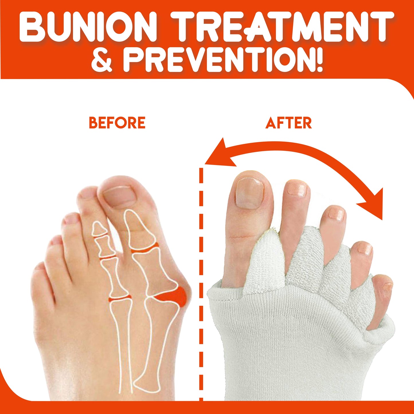AEXZR®  Bunion Relief Toe Socks