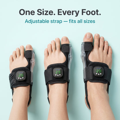Limited Stock!!! AEXZR® Nexalign Pro — EMS Bunion Corrector
