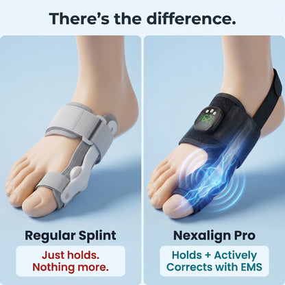 Limited Stock!!! AEXZR® Nexalign Pro — EMS Bunion Corrector